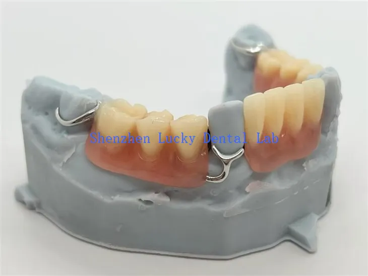 T - بار ہک کے ساتھ 3D پرنٹ ایکریلک پارٹیلس