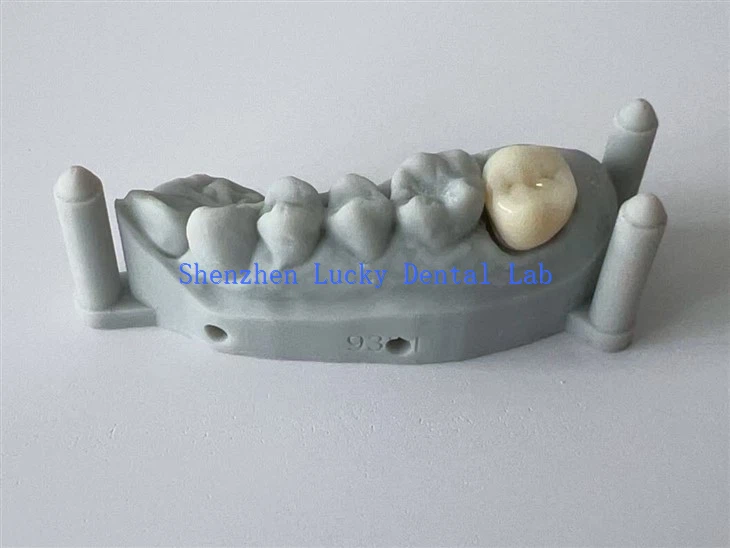 3D پرنٹ ڈینٹل تمام سیرامک زرکونیا کا تاج چین میں بنایا گیا ہے