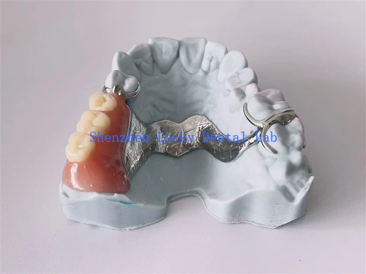 3D پرنٹ ڈینٹل سی او سی آر دھات کا فریم ورک ڈبل ایکر ہک کے ساتھ