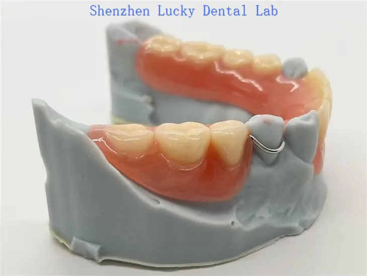 تار ہک کے ساتھ ایکریلک ہٹنے والا جزوی دندان