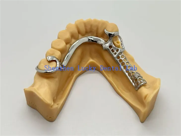 کوبالٹ کروم فریم ورک