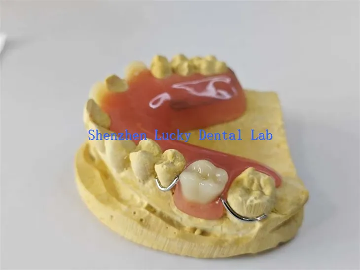 آرام دہ اور پرسکون تار موڑنے والی ہک ایکریلک ڈینچر ڈینٹل لیب