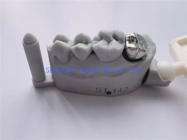 آرام دہ اور پرسکون دانتوں کا مکمل دھات کا تاج