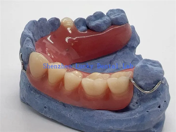 تار ہک کے ساتھ آرام دہ جزوی ایکریلک ڈینچر