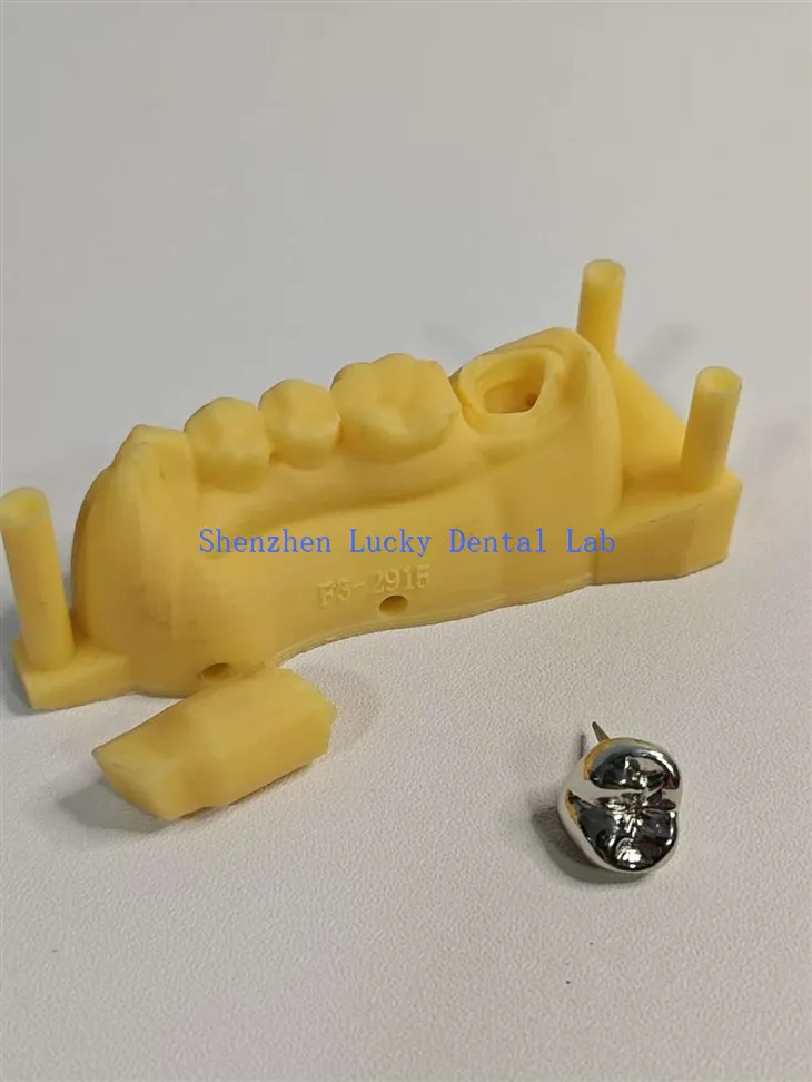 اپنی مرضی کے مطابق 3D پرنٹ ڈینٹل ایف ایم سی مکمل دھات کا تاج