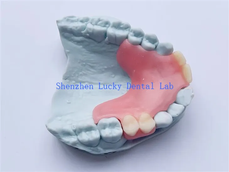 مینوفیکچررز میں اپنی مرضی کے مطابق دانتوں کا جزوی لچکدار دانتوں کی کوشش کریں