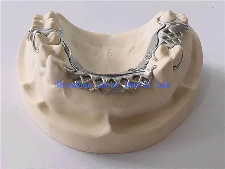 دانتوں کے سی او سی آر دھات کے فریم ورک مینوفیکچررز