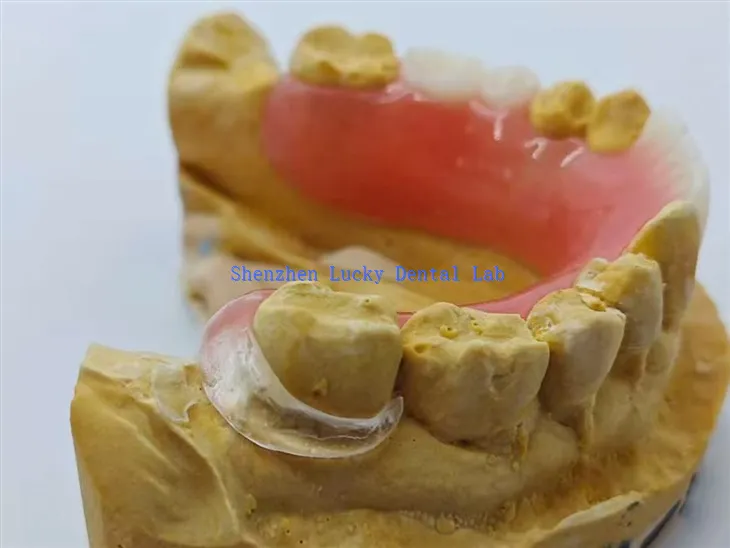 واضح ہک کے ساتھ ایکریلک ڈینچر