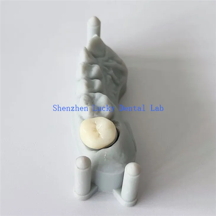 اعلی معیار کی 3D پرنٹ دانتوں کا تمام سیرامک ​​زرکونیا تاج