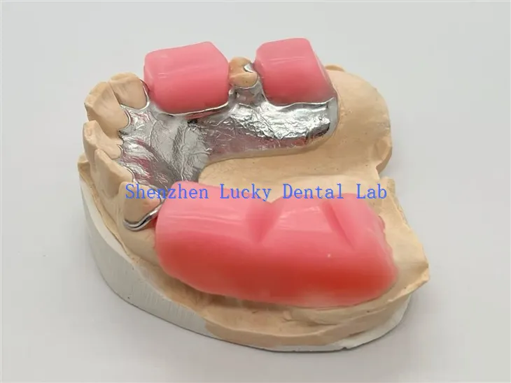 کاٹنے کے بلاک کے ساتھ دھات کا فریم