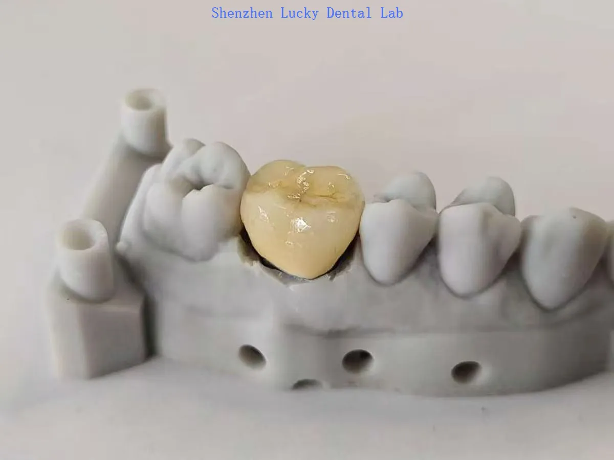 2025-08-25105146890 2025-08-25105146890