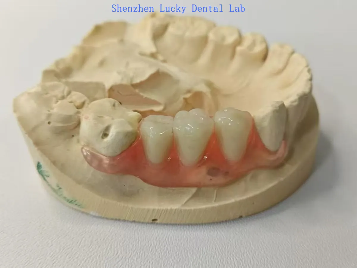 2025082811215717297 2025082811215717297