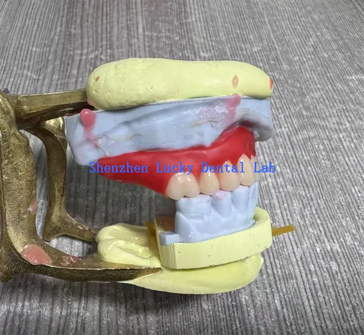 اپنی مرضی کے مطابق 3D پرنٹ ڈینٹل مکمل ایکریلک ڈینچر ڈینٹل لیب میں آزمائیں